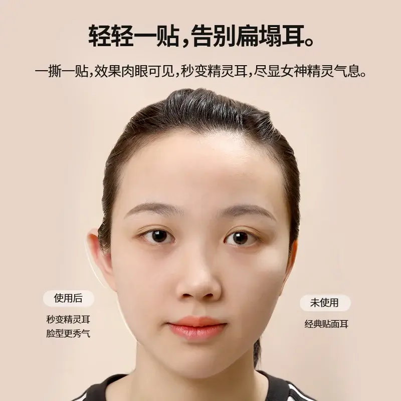 精灵耳贴招风立耳贴固定贴显脸小拍照矫正支撑器